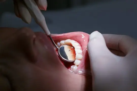 dentysta ogląda zęby